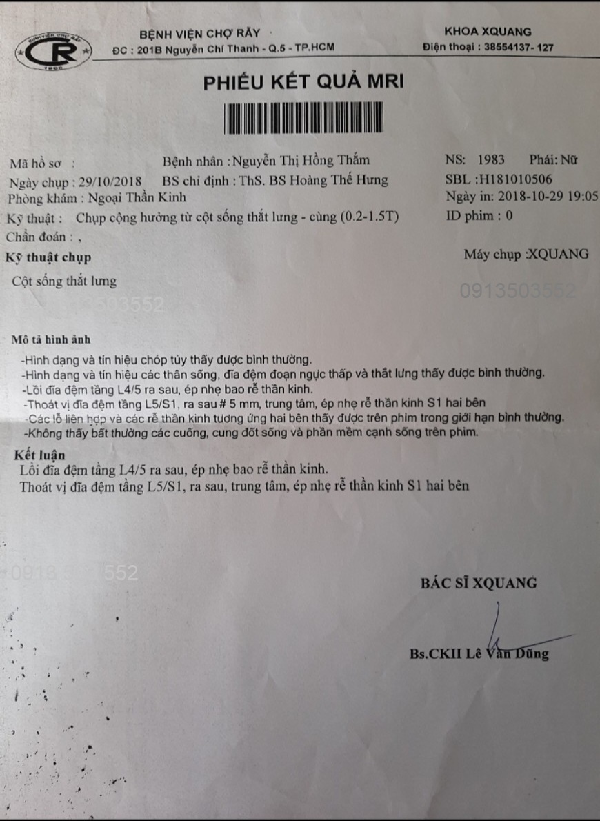 Thoát vị đĩa đệm L5 S1